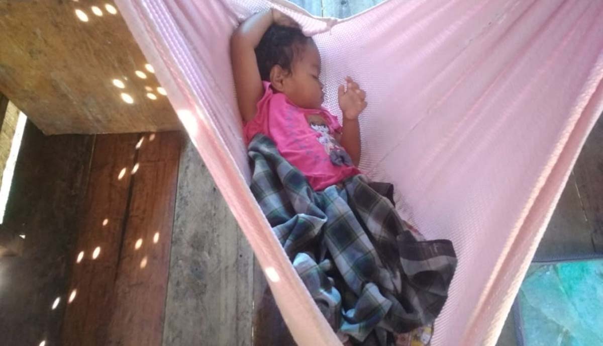 Putri Bilqis Alisyah, balita menderita bocor jantung butuh bantuan para dermawan. (foto: istimewa)