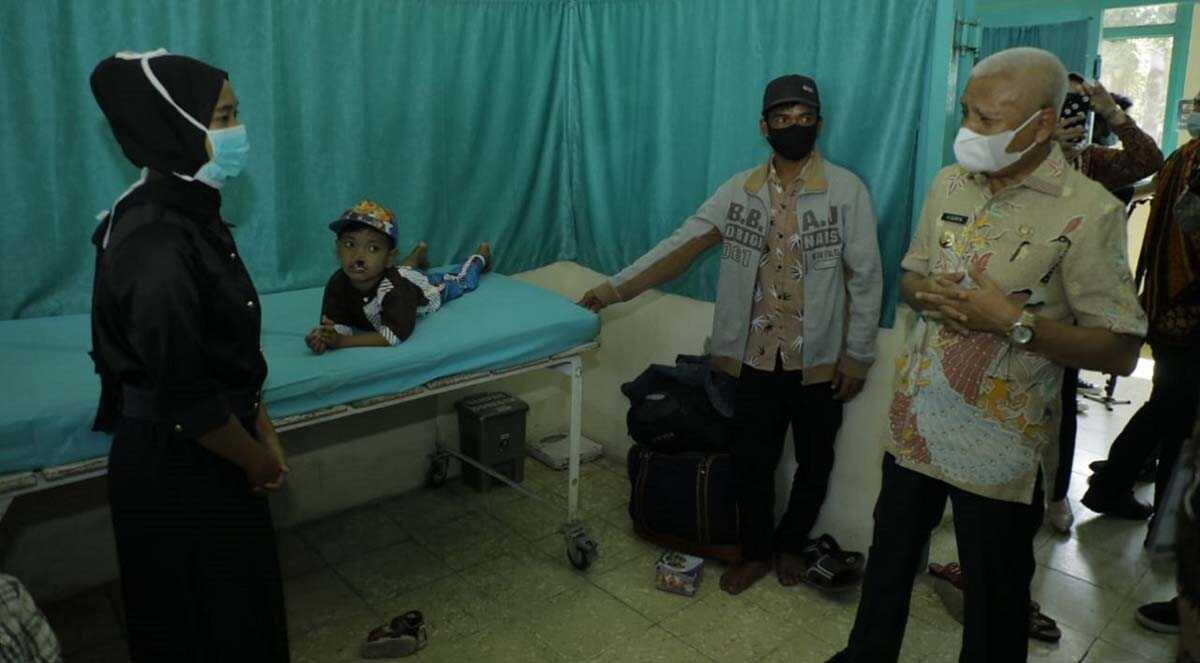 Operasi Bibir sumbing asahan Bupati Asahan Surya meninjau bakti sosial operasi bibir sumbing di RS Ibu Kartini, Kisaran, Jumat (25/6/2021)
