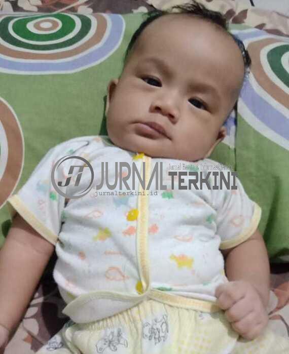 Habib bayi di karimun mengidap kelainan jantung Kisah Habid, Bayi di Karimun yang Terlahir Tanpa Anus dan Mengidap Kelainan Jantung
