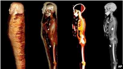 lapisan mumi mesir Lapisan mumi Mesir yang berasal dari 330 SM hasil pemindaian CT (computed tomography), dalam foto selebaran yang dirilis 24 Januari 2023. (Sahar N. Saleem via AP)