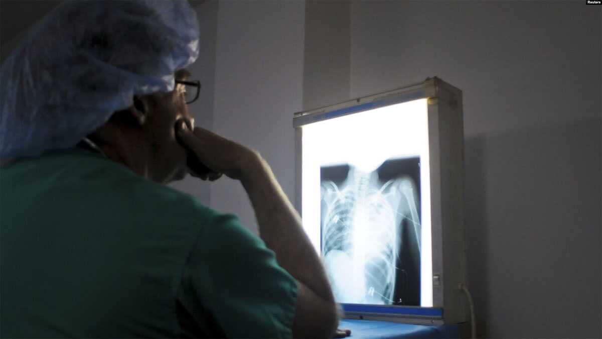 rontgen jantung Dokumen VOA - Seorang dokter tengah memeriksa rontgen jantung pasien di Klinik Degand, Port-au-Prince, 15 April 2012.