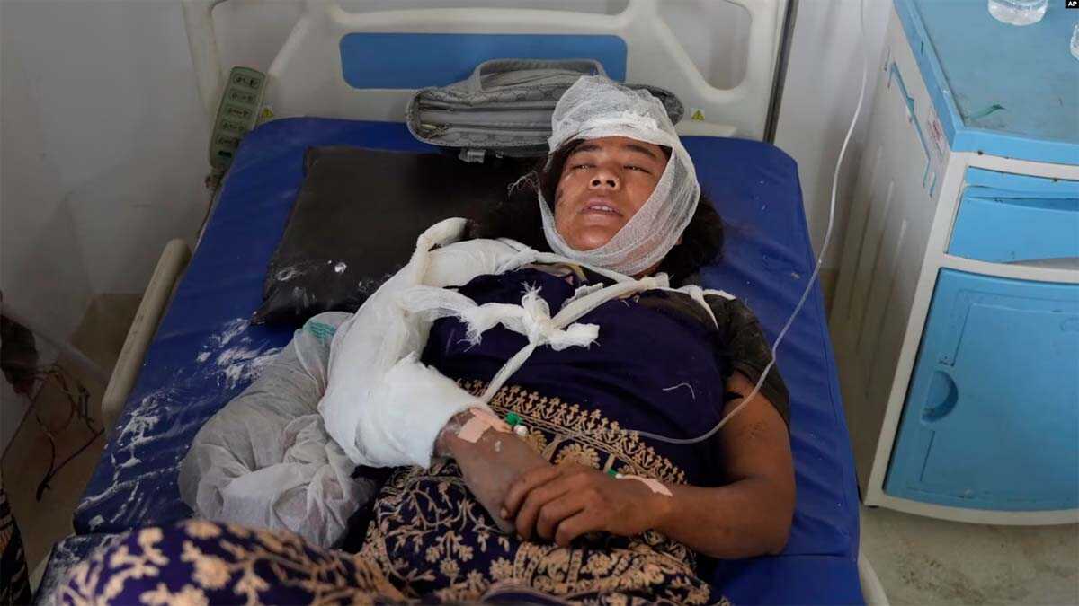gempa di nepal-1 Seorang korban gempa sedang dirawat di Rumah Sakit Bheri di Nepalgunj, Nepal, Sabtu, 4 November 2023. (Foto: Niranjan Shrestha/AP Photo)