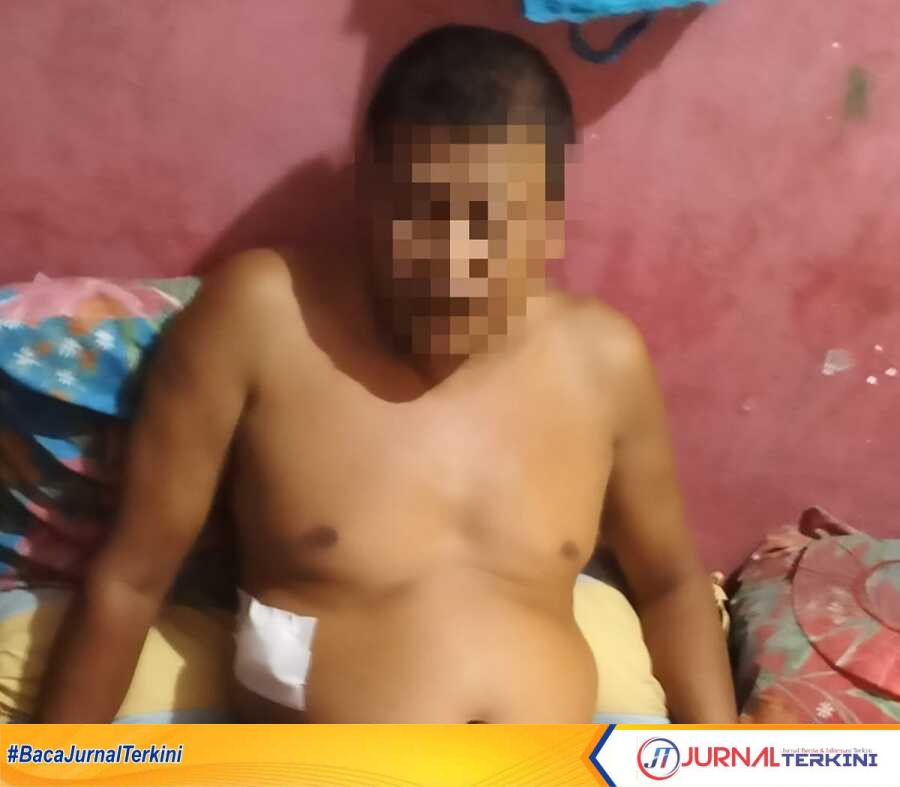 Supir mobil travel yang jadi korban begal di jalan lintas Curup-Linggau mengalami luka tusukan di perut, Jumat (1/12/2023). (JurnalTerkini.id/alam budi kesuma)